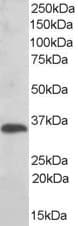 IHC-plus™ TXNDC1 / TMX1 Antibody (aa269-280)