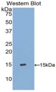 S100A9 / MRP14 Antibody (aa1-114)