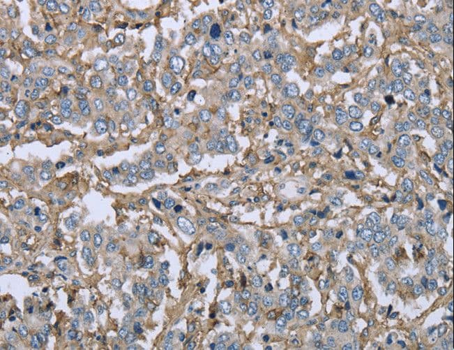 FCGR2 / CD32 Antibody