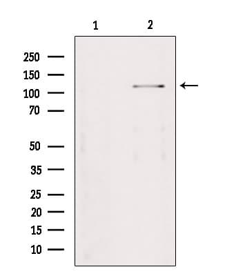 Polyclonal Rabbit anti-Human TAOK2 / TAO2 Antibody (WB)
