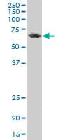 Monoclonal Mouse anti-Human PCK2 / PEPCK Antibody (clone 2C9, WB)