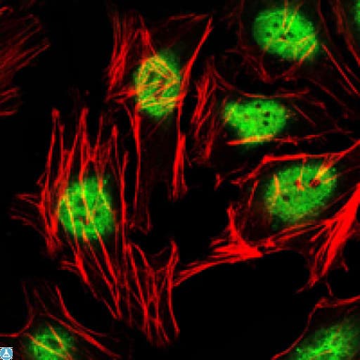 ZBTB16 / PLZF Antibody