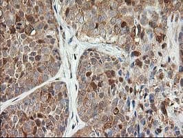Monoclonal Mouse anti-Human LSM1 Antibody (clone OTI5C6, IHC, IF, WB)