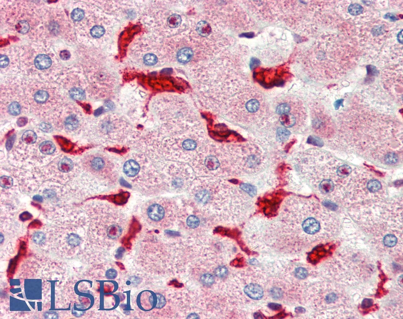 IHC-plus™ Polyclonal Rabbit anti-Human HMOX1 / HO-1 Antibody (IHC, WB)