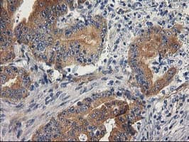 BCAR1 / p130Cas Antibody (clone OTI3A5)