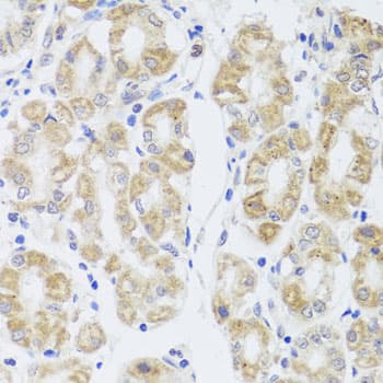 MIP / AQP0 / Aquaporin 0 Antibody