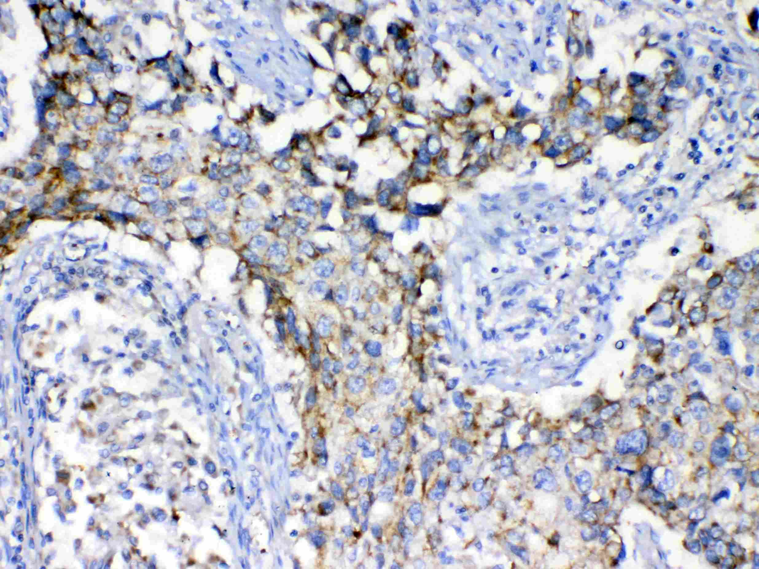 Polyclonal Rabbit anti-Human KITLG / SCF Antibody (IHC, WB)