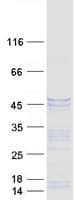 Human DCX / Doublecortin Protein (Recombinant Myc-DDK (Flag))