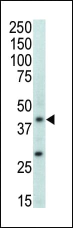MAPK11 / SAPK2 / p38 Beta Antibody (aa334-366)