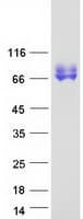 Human LIMPII / SCARB2 Protein (Recombinant Myc-DDK (Flag))