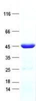 Human PDLIM3 Protein (Recombinant His, N-Terminal)