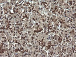 RAB30 Antibody (clone OTI3B1)