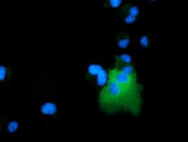 Monoclonal Mouse anti-Human ARHGAP25 Antibody (clone OTI12E6, IHC, IF, WB)