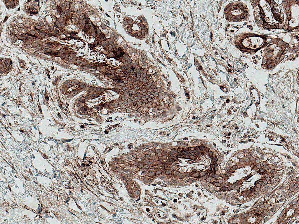 MMP7 / Matrilysin Antibody