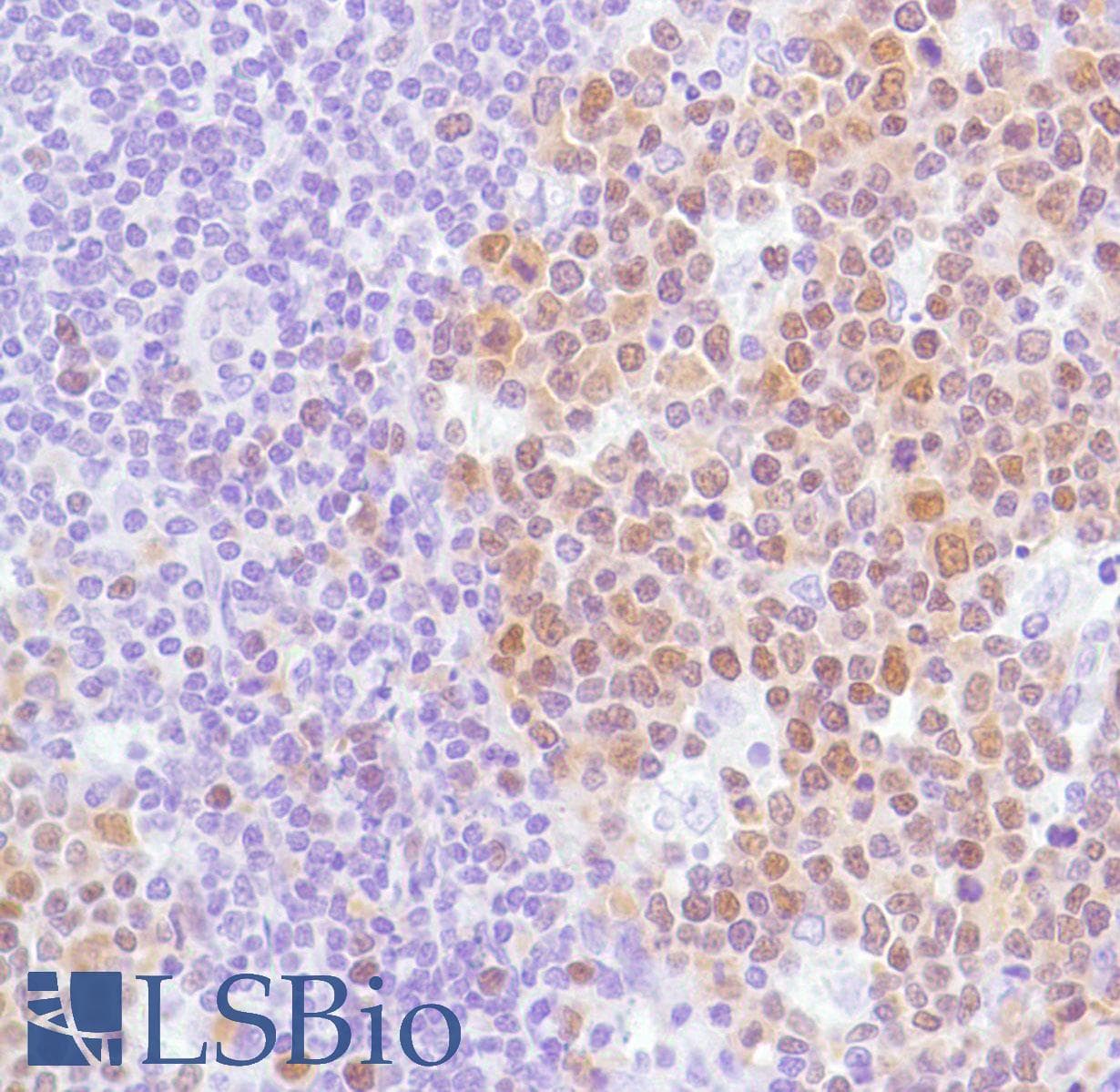 Monoclonal Rabbit anti-Human BCL6 Antibody (clone SP155, C-Terminus, IHC)