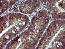 DNM1L / DRP1 Antibody (clone OTI4A4)