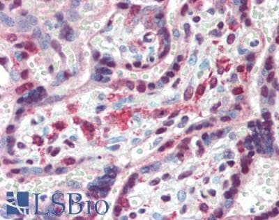 IHC-plus™ Polyclonal Rabbit anti-Human PPARG / PPAR Gamma Antibody (IHC, WB)