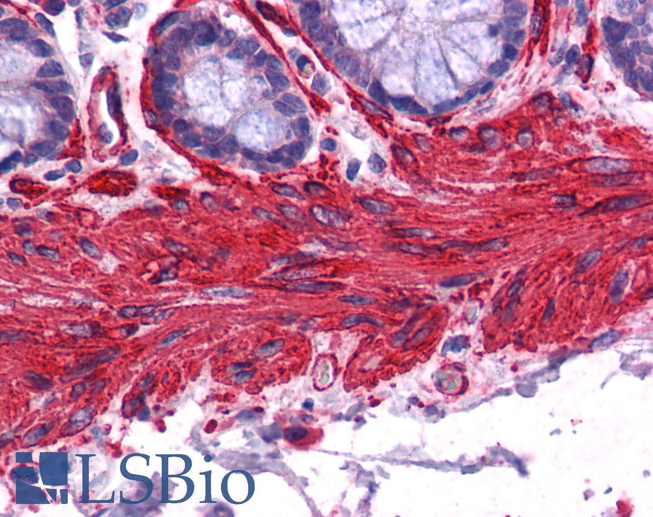 PathPlus™ ACTA2 / Smooth Muscle Actin Antibody (aa1-50)