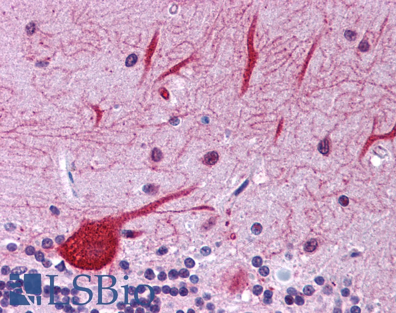 Polyclonal Rabbit anti-Human EIF2AK1 Antibody (aa108-157, IHC, WB)