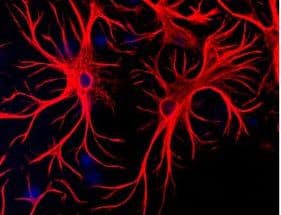 GFAP Antibody