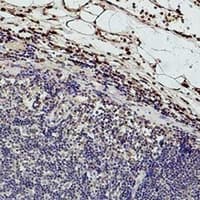 HIST1H3H Antibody