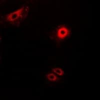 SCG2 / Secretogranin II Antibody