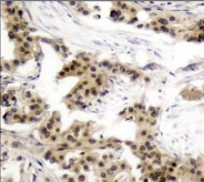 NFKB1 / NF-Kappa-B Antibody