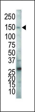 Polyclonal Rabbit anti-Human KDR / VEGFR2 / FLK1 Antibody (aa1326-1356, IHC, IF, WB)