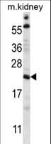 Polyclonal Rabbit anti-Human TTC33 Antibody (aa1-30, WB)