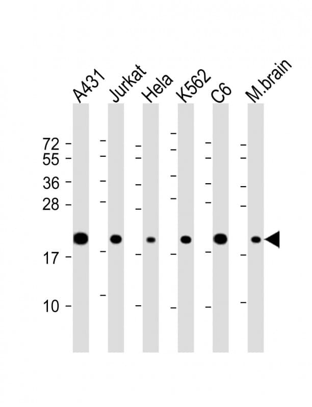 RPS10 / Ribosomal Protein S10 Antibody (C-Terminus)