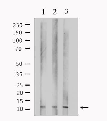 TUSC2 / FUS1 Antibody