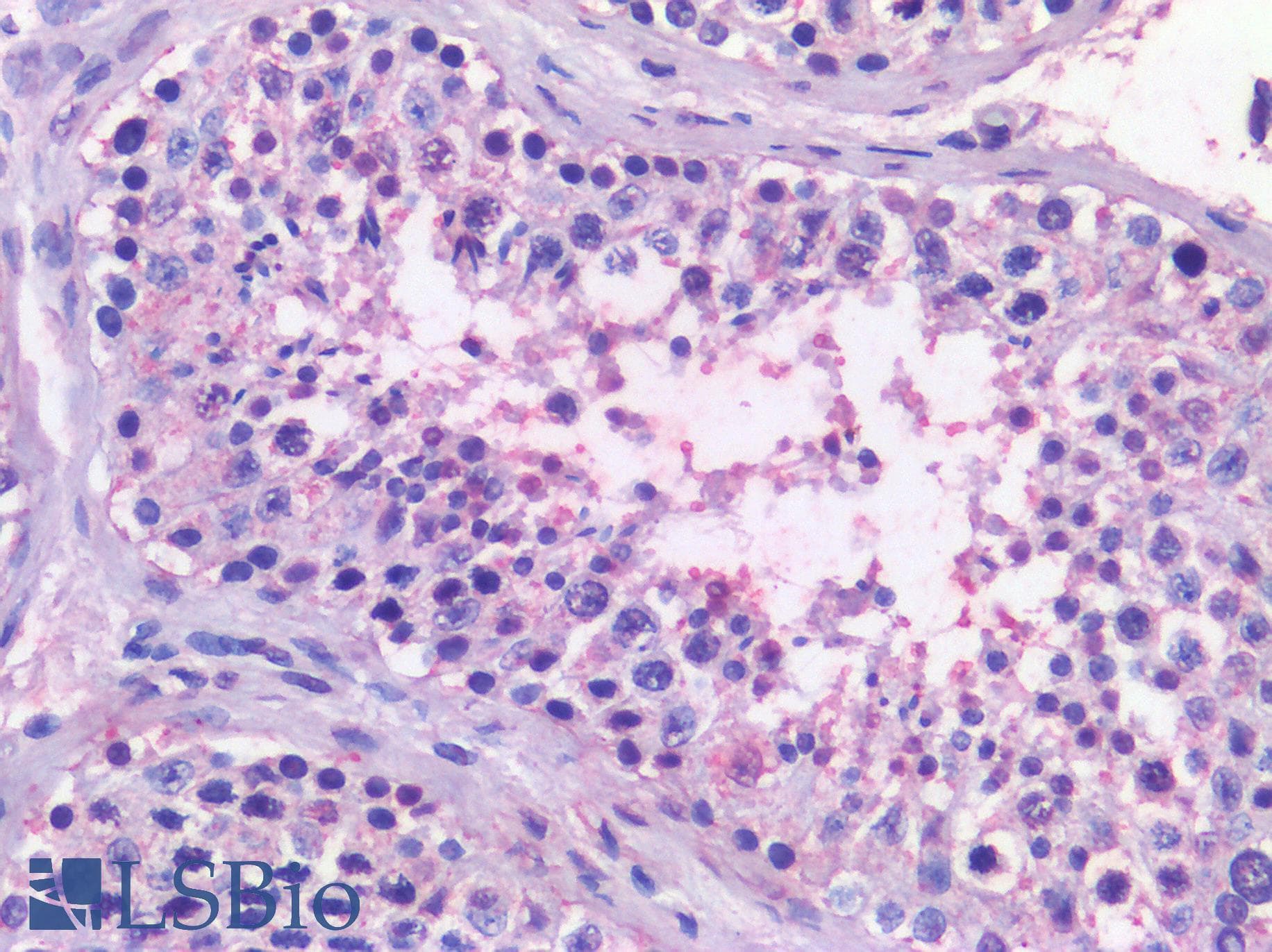 PathPlus™ NR5A1 / SF1 Antibody (Internal)