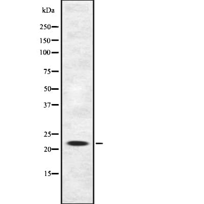 Polyclonal Rabbit anti-Human IFNA21 / Interferon Alpha 21 Antibody (WB)