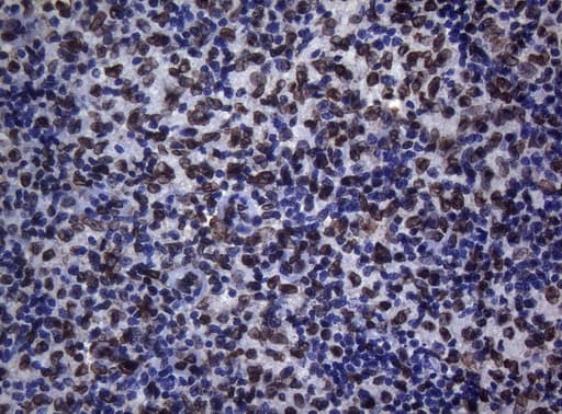 BCL6 Antibody (aa1-300, clone OTI1C3, Carrier-free)