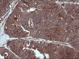 MAP2K3 / MEK3 / MKK3 Antibody (clone OTI2A7, Carrier-free)