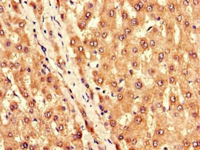 KCNJ11 / Kir6.2 Antibody