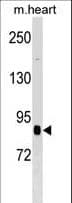 CUL2 / Cullin 2 Antibody (aa150-179)