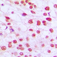 RB1 / Retinoblastoma / RB Antibody (C-Terminus)