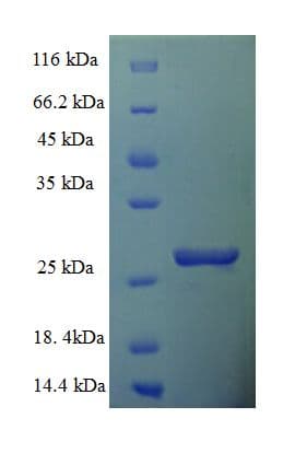 Human TIMM10B / FXC1 Protein (Recombinant His-SUMO)