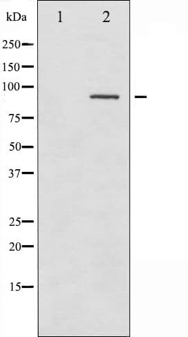 Polyclonal Rabbit anti-Human SYK Antibody (phospho-Tyr323, IHC, IF, WB)
