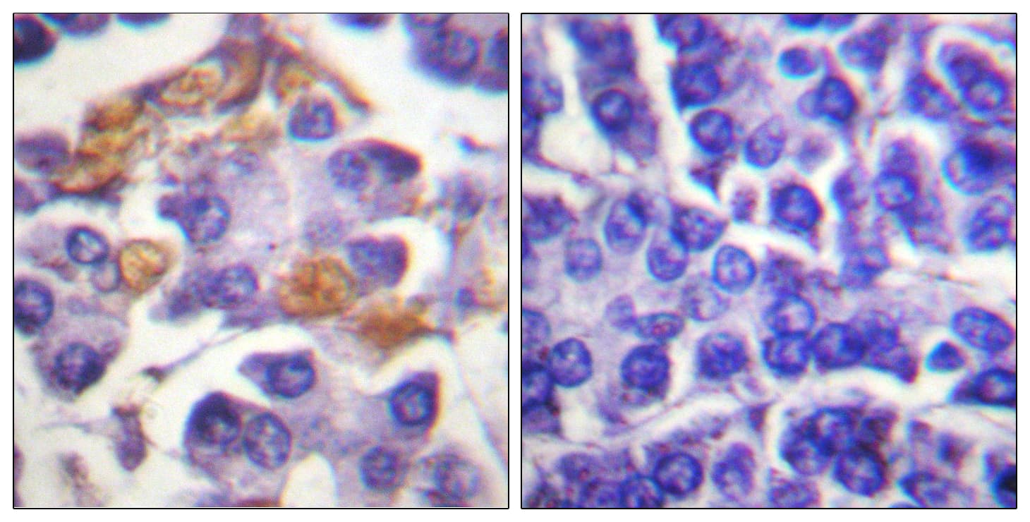 RAF1 / RAF Antibody (phospho-Tyr341)