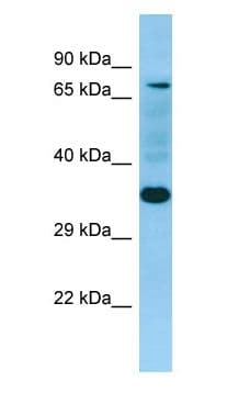 Polyclonal Rabbit anti-Human SELPLG / PSGL-1 / CD162 Antibody (N-Terminus, WB)