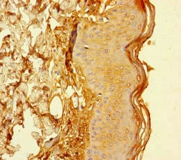 Polyclonal Rabbit anti-Human (CYREN) C7orf49 Antibody (IHC)
