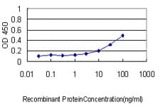 Monoclonal Mouse anti-Human IL11RA Antibody (clone 2D4-F4, WB)