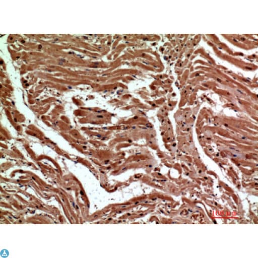 CLEC6A / Dectin 2 Antibody