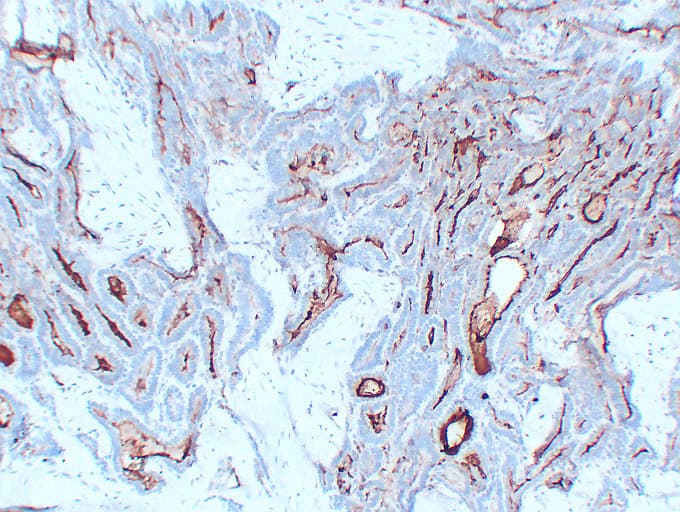 TG / Thyroglobulin Antibody (clone ABT-TG)