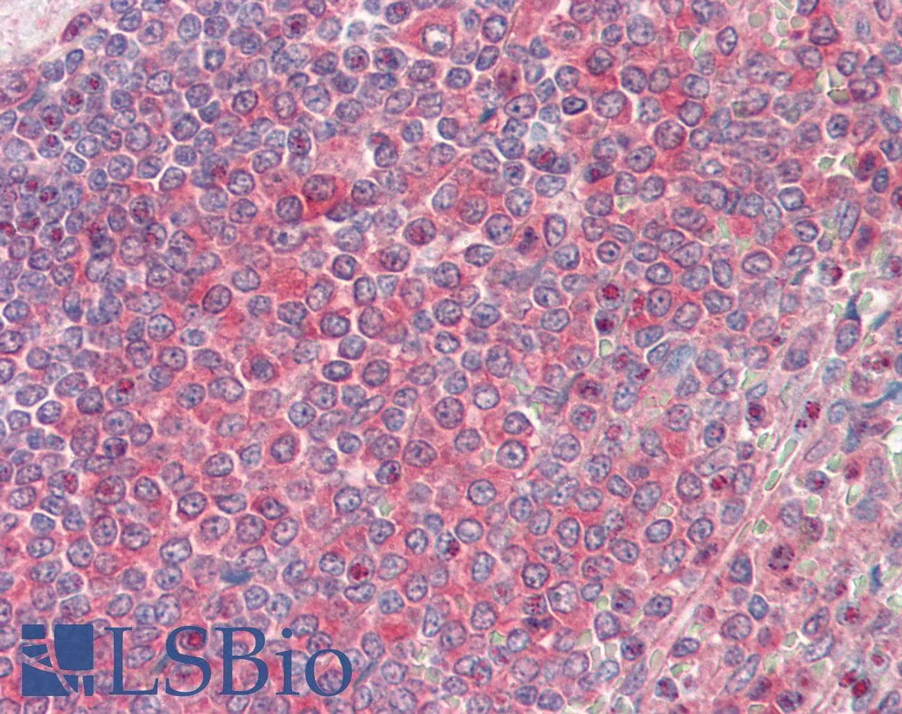 IHC-plus™ NME2 Antibody (aa91-140)