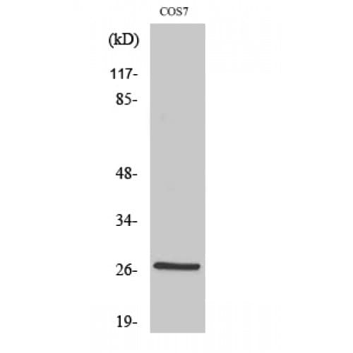 Polyclonal Rabbit anti-Human HSPB1 / HSP27 Antibody (1-80 aa, IHC, WB)