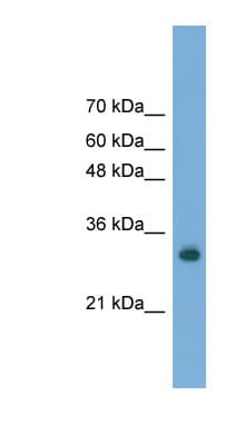 Polyclonal Rabbit anti-Human FAM78A Antibody (aa211-260, WB)