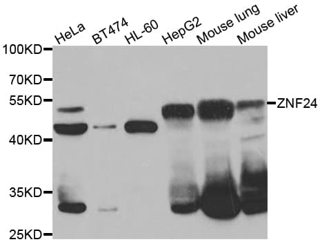 ZNF191 / ZNF24 Antibody